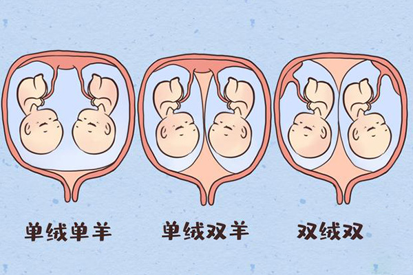 做试管有可能形成同卵双胞胎