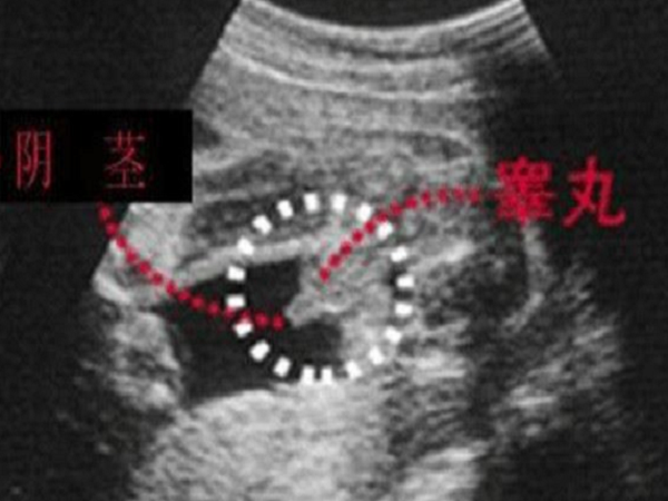 身体正常想要男孩不能做试管