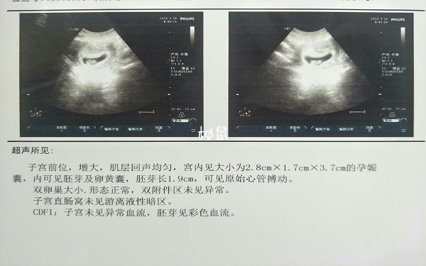 通常孕囊大小数据是3个