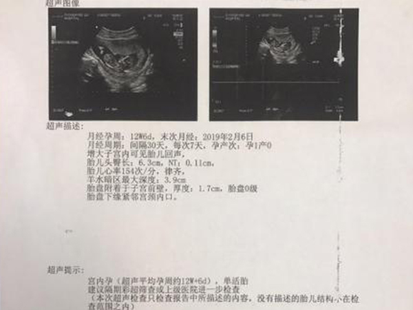 医生说宝宝可爱并非暗示胎儿性别