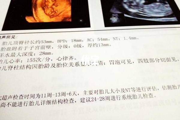 怀孕3个月胎儿头臀长在40-80mm之间