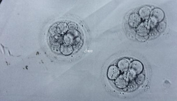 三代试管10个囊胚能筛出3个