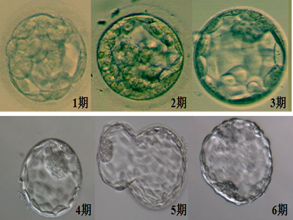 4aa胚胎生男生女概率一样