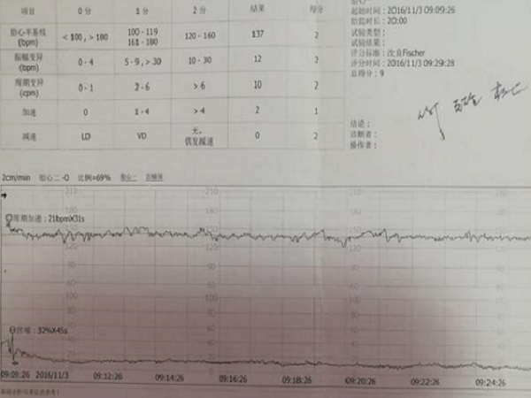 胎心率在140左右的一般就是男宝宝