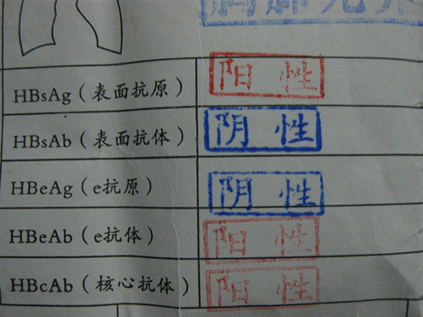 乙肝五项指标检测方法