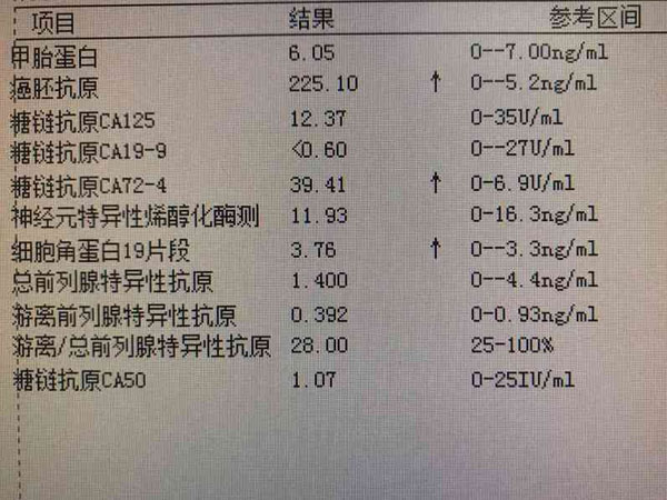 患盆腔炎会导致糖类抗原125偏高