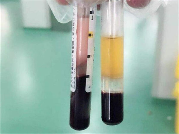 HCG数值大于10μg/L基本可以确定怀孕