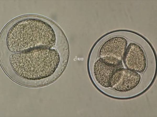 试管婴儿不能选择龙凤胎