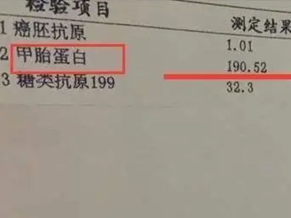 胎儿患先天性心脏疾病会导致甲胎蛋白含量降低