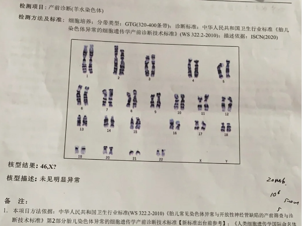 羊水穿刺可检查染色体是否异常