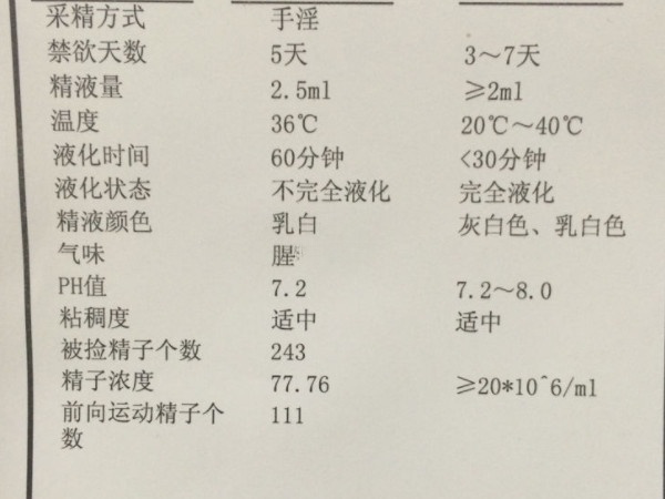 做试管婴儿前要检查精液