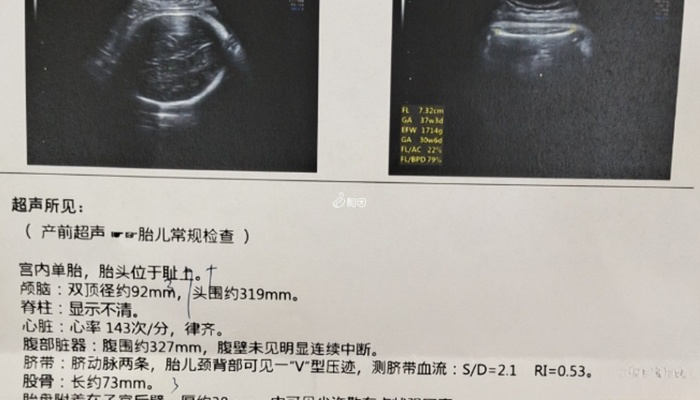 第一次产检在孕6周