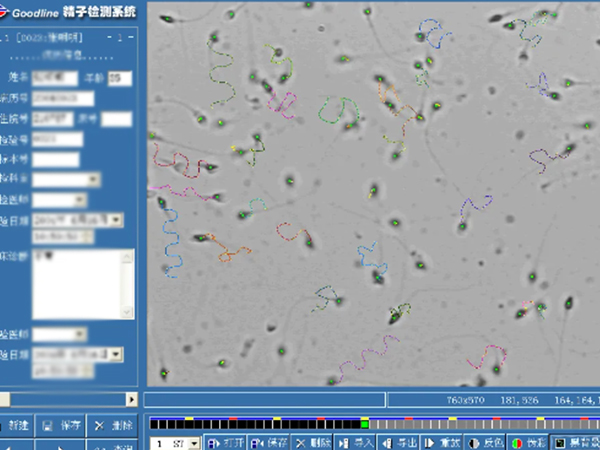 检测精子最好是禁欲3~7天