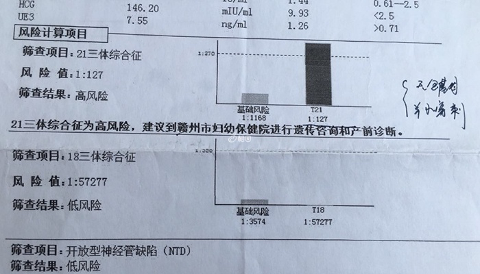 唐筛高风险可以做羊水穿刺