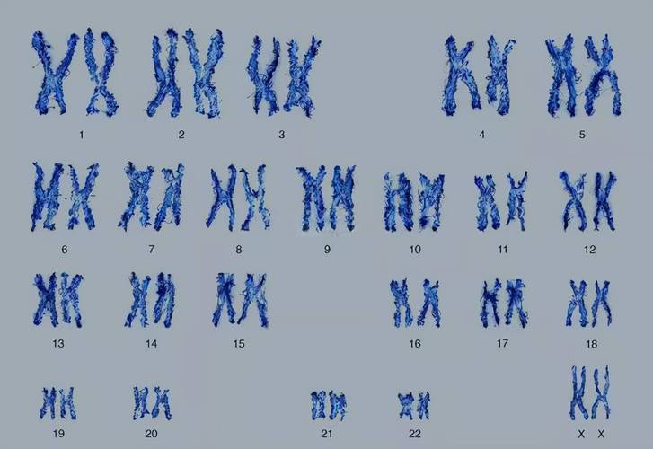 基因芯片是比染色体核型更准