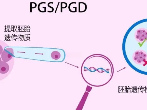 胚胎没过pgs筛查不建议移植