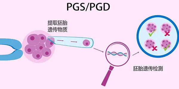 三代PGS筛查准确性较高